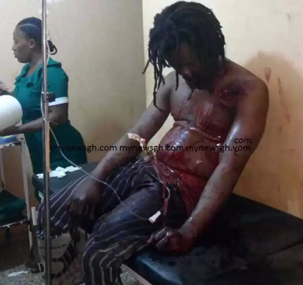 Blood Everywhere: Fetish Priest Suffers Serious Gunshot Wound While Attempting to Test His Supernatural Powers (Photo)